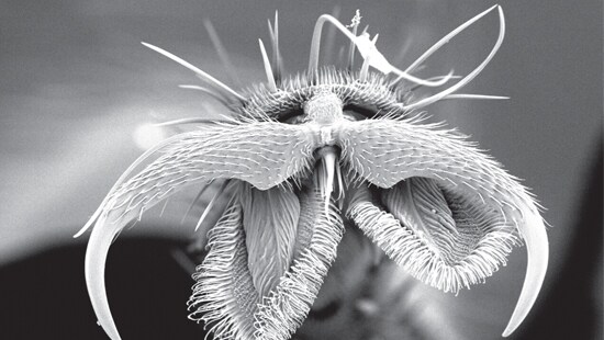 Fly Feet Under Microscope